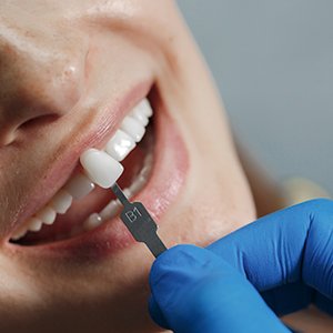 dentista na barra servico lentes odontologicas